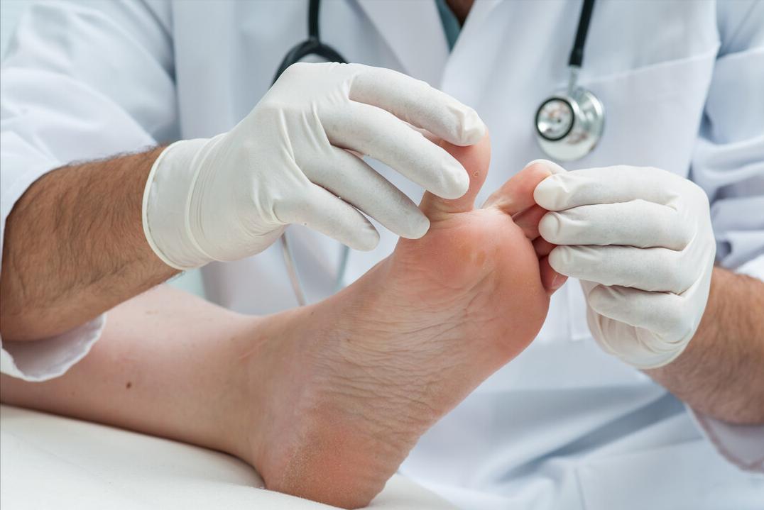 甲沟炎的倒刺要不要剪掉,手上的倒刺不长拔会得甲沟炎吗