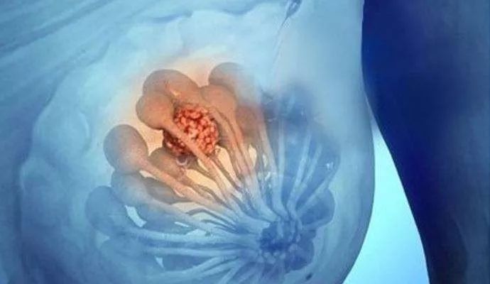 身体有结节囊肿息肉怎么调理,为什么总是长囊肿息肉结节等疾病