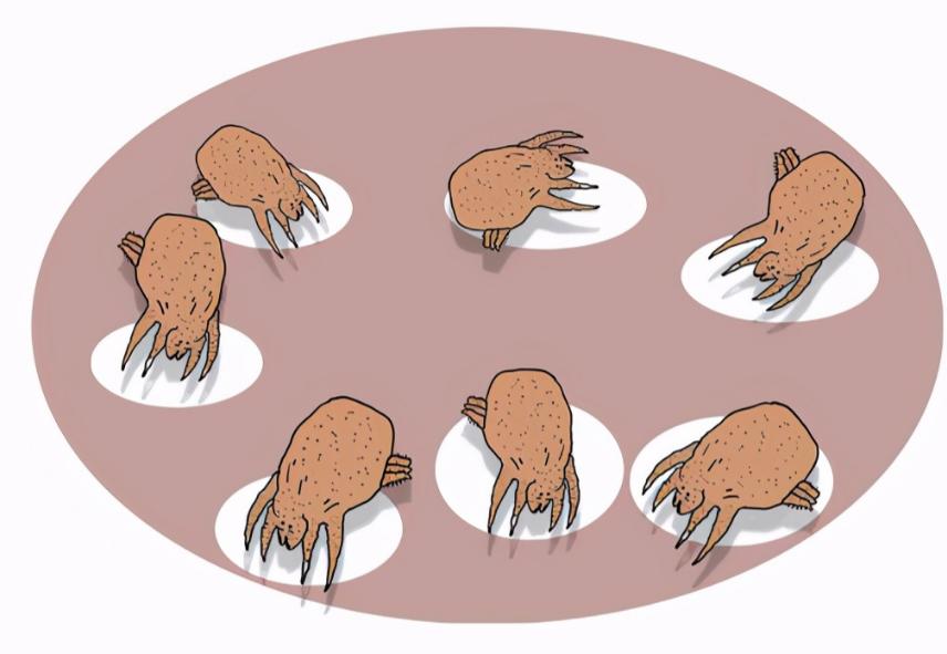 耳朵总是痒却又掏不出东西怎么办,耳朵发痒用什么掏安全