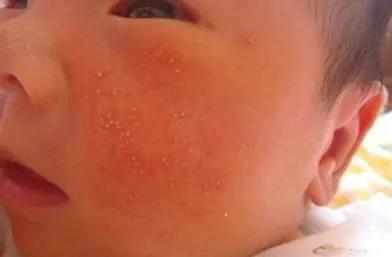 新生儿护理必备常识有哪些,护理室必备物品清单