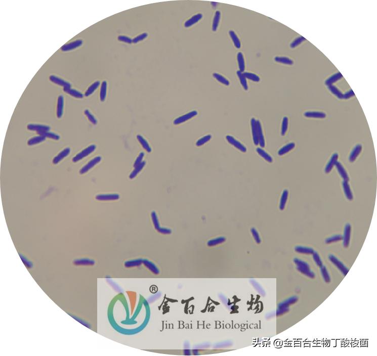 革兰氏染色显微镜下的图手绘,革兰染色用的显微镜是什么