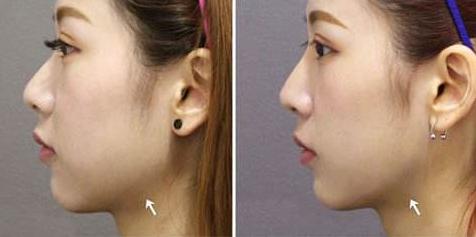 小米产品暴利行业,小米有品营收破千亿