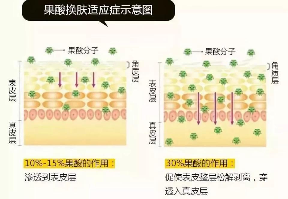 要小心！贵妇级成分也不能乱叠加，这些组合只会越用越丑