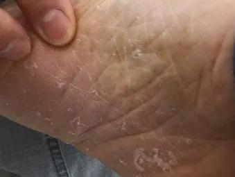 沈腾泡脚视频,沈腾谈治脚气