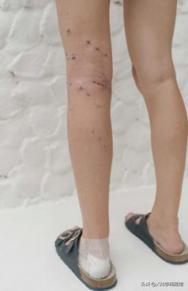 鳄鱼袭人，印尼村民愤怒*杀屠**300头，为什么说鳄鱼比鲨鱼还要凶残