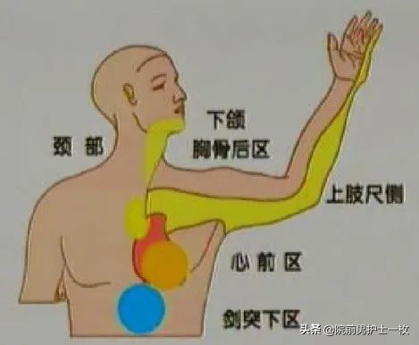 急性心梗的紧急处理视频,一旦发现急性心梗如何救