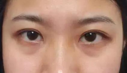 眼霜如何挑选先来看看这篇干货,眼霜推荐排行榜第一名怎么选