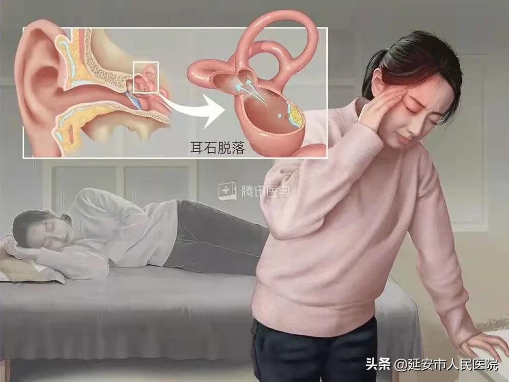 耳石症患者自述,耳石症问诊注意事项