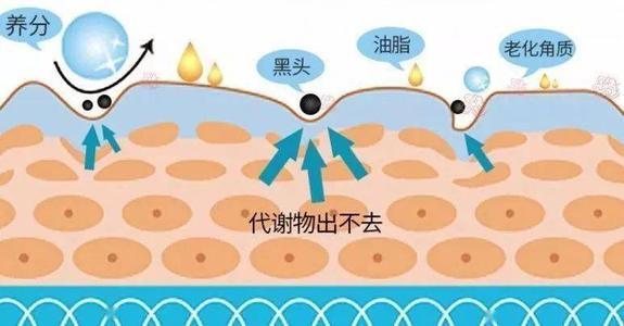 夏天出汗眼睛周围起疙瘩怎么回事,脸上眼睛周围有小米粒那样的疙瘩