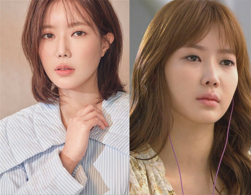 人中长怎么微调整容,人中两边宽怎么整容