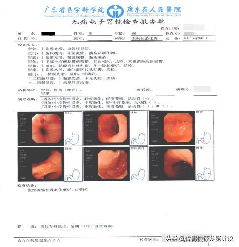 萎缩性胃炎离我们很近，我建议你看一看这篇文章