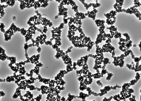 洗澡的时候搓下来的黑泥放大100倍,搓澡下来的黑泥是什么显微镜