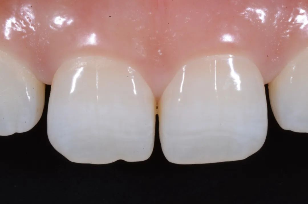 美白牙膏去牙黄真实有效测评,美白牙膏真实测评护牙效果