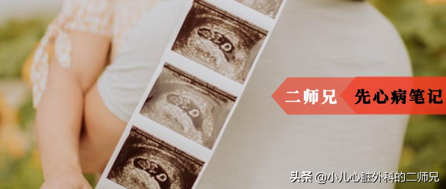 胎儿心脏畸形下次再怀孕会一样吗,胎儿心脏畸形预兆