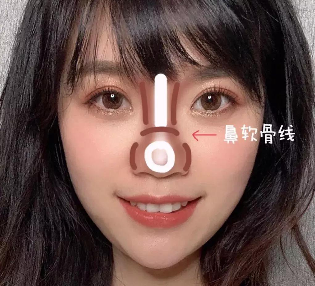 塌鼻子怎么办才显好看,塌鼻子如何让鼻根挺起来