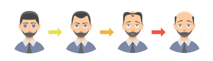 男性脱发会到什么时候停止?