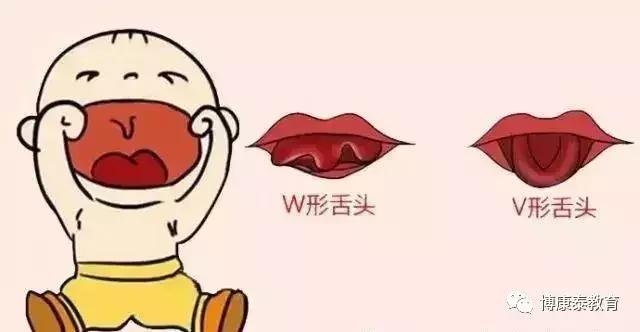 博康泰丨剪舌筋：该不该让孩子挨这一刀？