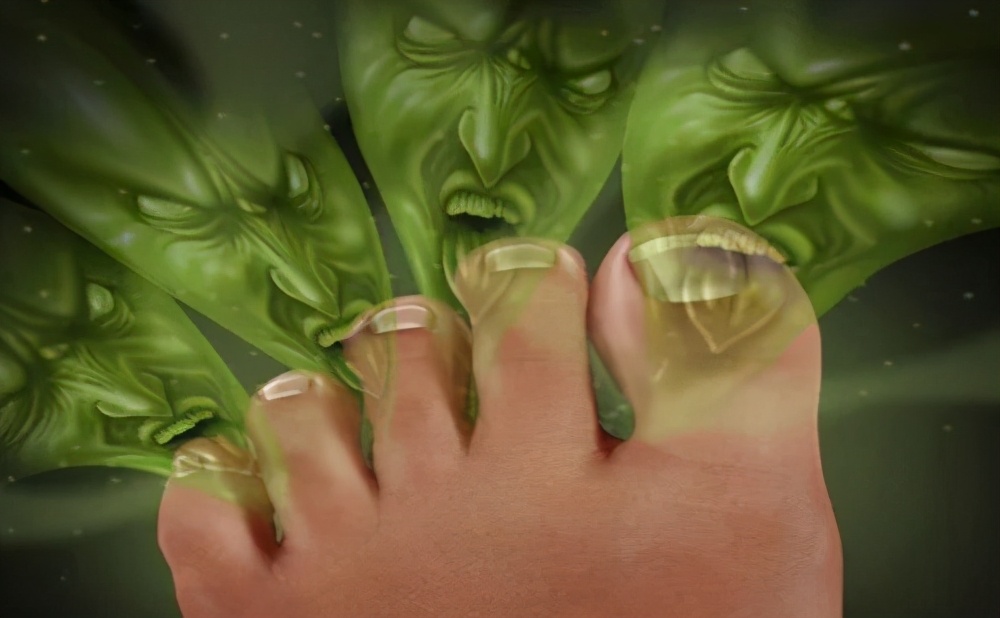 脚臭香港脚能根治吗,脚臭香港脚怎么办呢