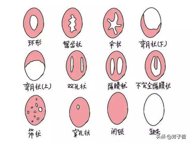 第一次用卫生棉条再加卫生巾吗,第一次用卫生棉条选择