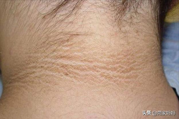 孕期变黑孩子会越来越好看,孕期变丑的10个征兆