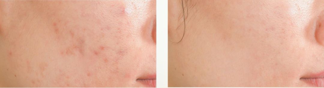 赵露思推荐补水保湿,赵露思推荐水感保湿焕颜面霜