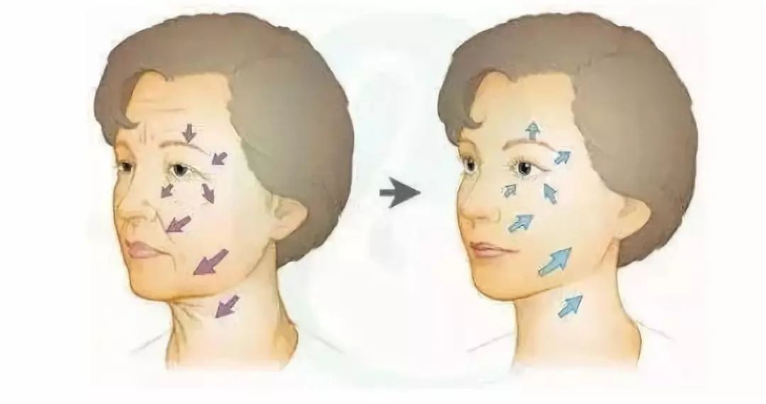 美颜都遮不住的法令纹该怎么回答,滤镜才是法令纹的天敌