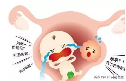 孕期分泌物多是有炎症吗,孕期分泌物增多会引起炎症吗