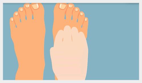 相信偏方不如相信抗菌鞋垫！不然一通操作猛如虎结果治疗全没谱