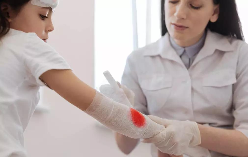 血管瘤破了可以擦碘伏吗,嘴唇血管瘤破溃结痂能不能恢复