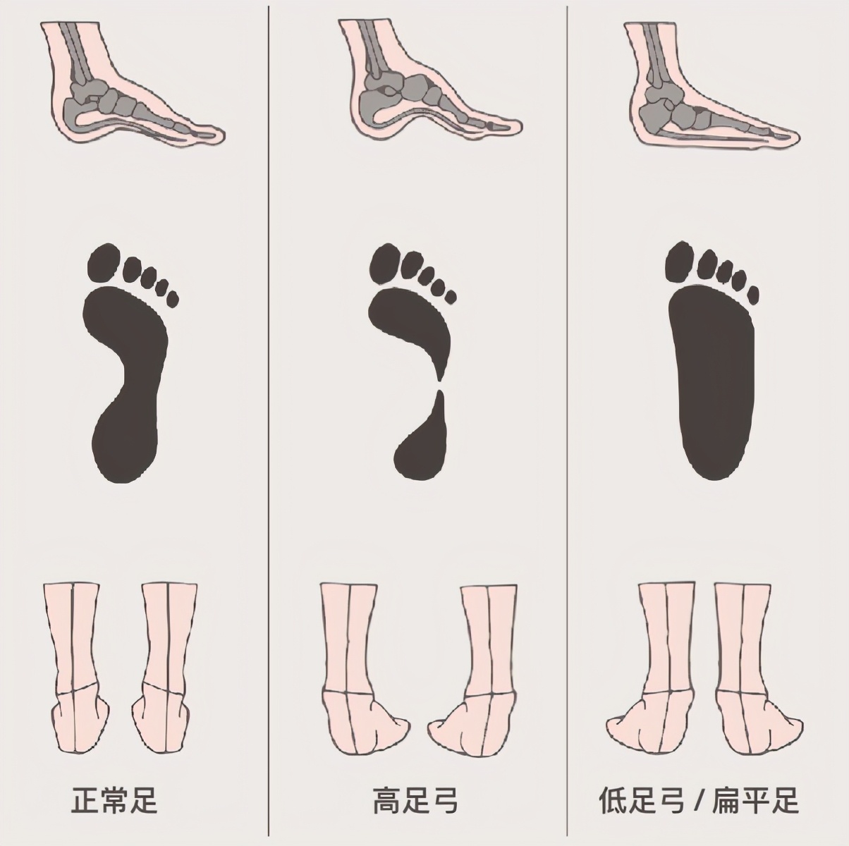 踝关节在崴脚是经常内翻还是外翻,经常崴脚怎么加强踝关节力量