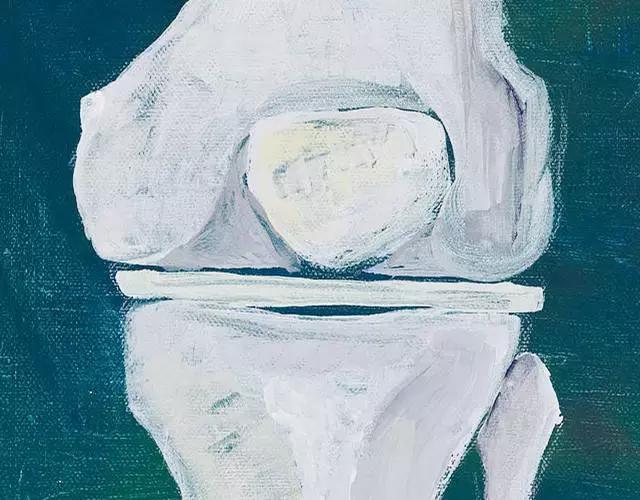 膝关节置管术和膝关节置换修补术,膝关节置换与全膝关节置换的区别