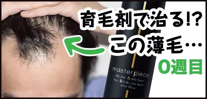 第一批90后已经秃了,第一批90后开始秃顶了