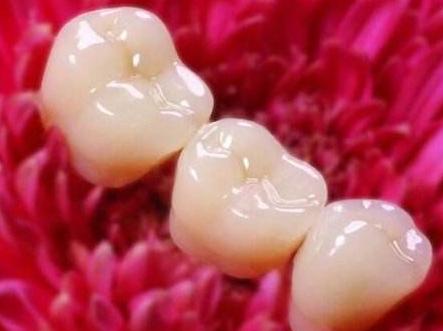 做了个烤瓷牙，里面的牙齿却烂掉了？