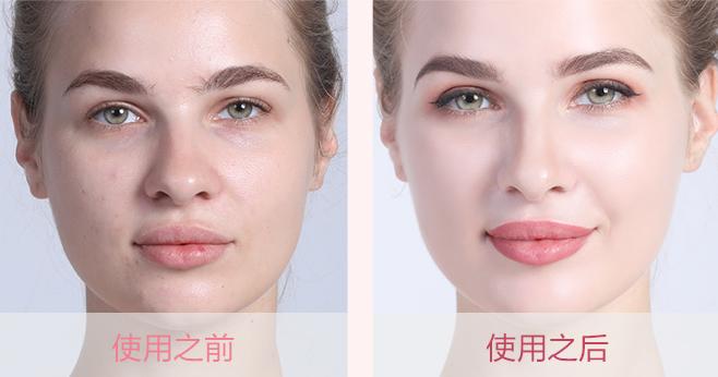 做美容的女人勇气可嘉,打了美容针的女人现在怎么样了