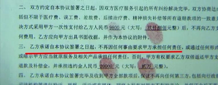 取耳软骨垫鼻尖效果图,取软骨垫鼻后软骨长什么样