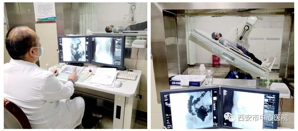 放射科钡餐检查,放射科检查前准备科普视频