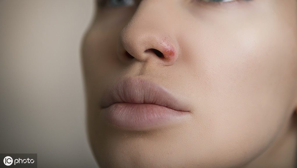 歪鼻和畸形鼻矫正怎么操作,歪鼻畸形应该如何进行矫正