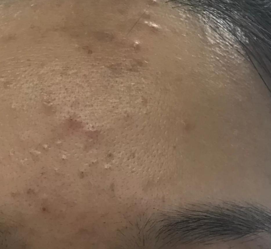 脸上的小瑕疵用什么护肤品比较好,脸部护肤的十大误区