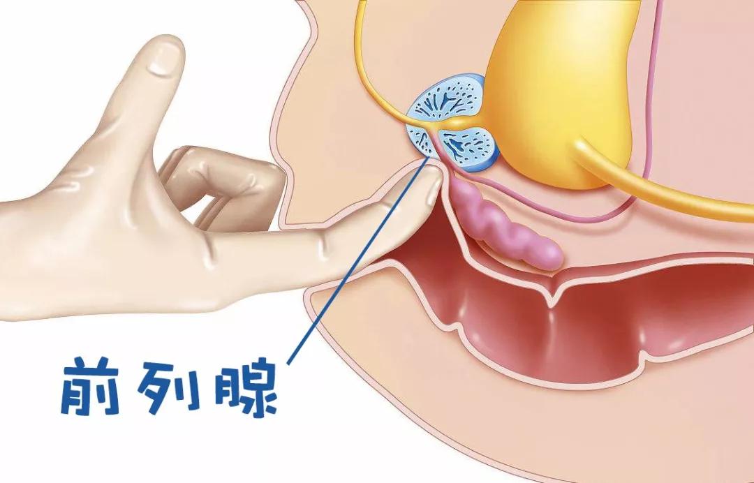 前列腺癌如何用中医治,前列腺癌患者最长生存期