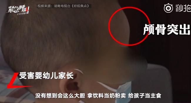 湖南出现多名大头娃娃只因喝了这款“毒奶粉”