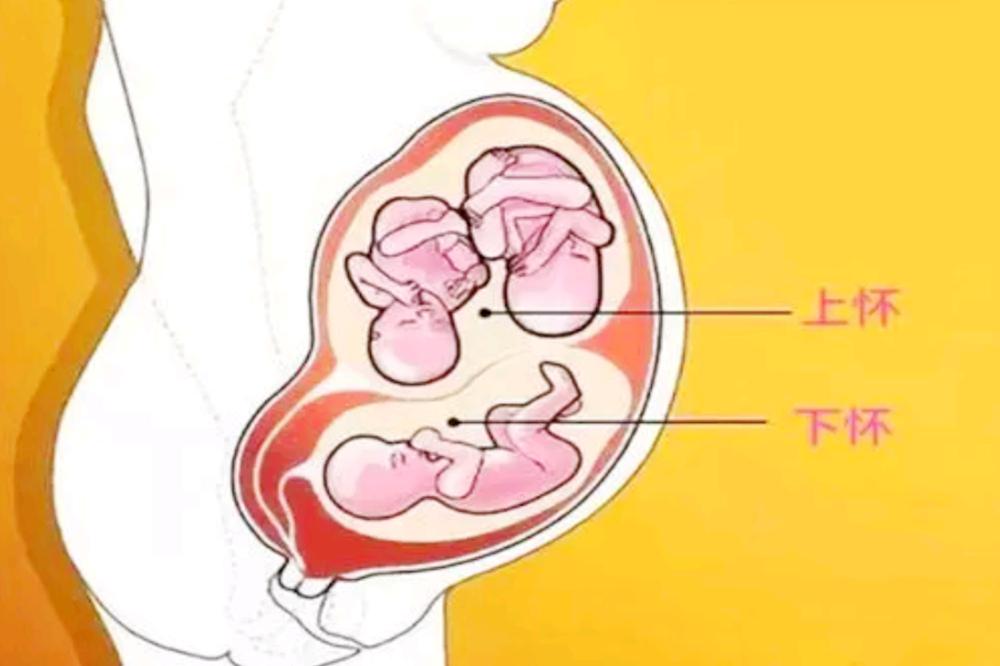 上怀下怀跟孕妈胖瘦有关系吗,孕妈胎动在下方是上怀还是下怀