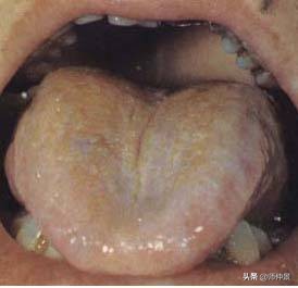 最实用的舌诊图六大舌象,舌诊深入学习书