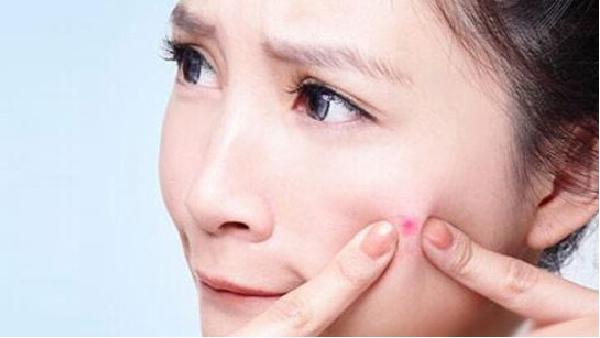 去螨控油皂排行榜,效果超好的去螨虫皂