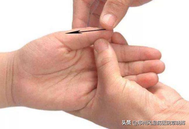 儿童类风湿的4个征兆,儿童得类风湿性关节炎严重吗