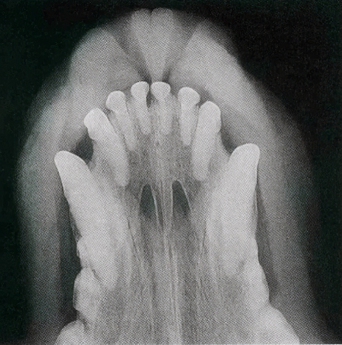 猫咪蛀牙可以洗掉吗,猫咪牙齿蛀牙怎么办