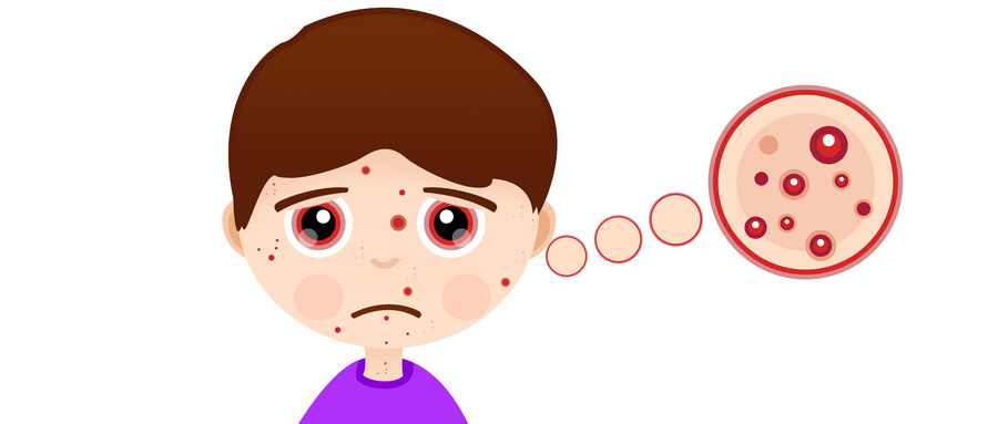 嘴唇下巴老是长痘痘是什么原因,下巴下面总是长痘痘是什么原因