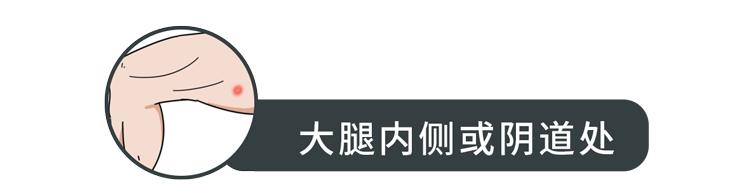 不同部位长痘痘的原因及解决方法,不同地方长痘痘的原因和改善方法