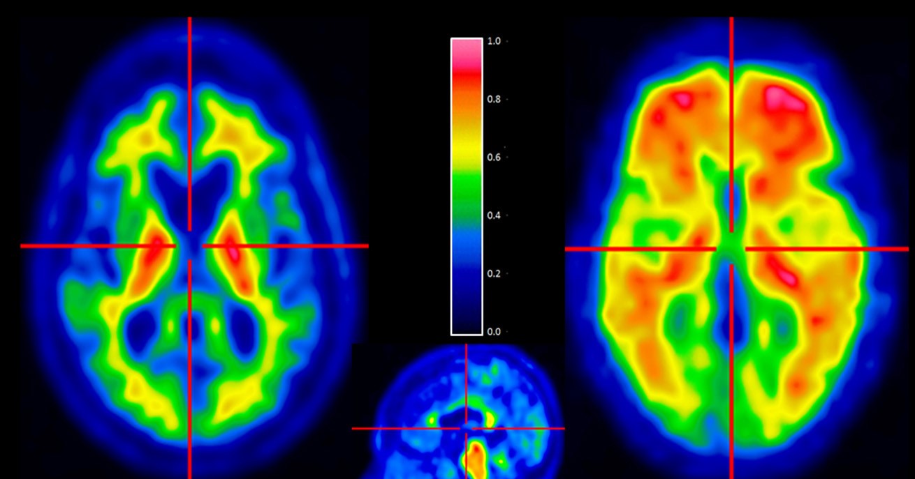 爱因斯坦大脑和平常人大脑对比,爱因斯坦如何开发大脑