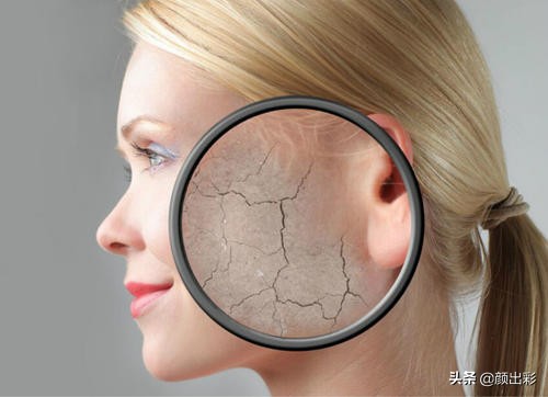 为何总感觉脸紧绷绷的,脸部干燥紧绷红肿刺痛怎么办