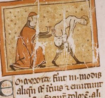 烙铁治疗痔疮,用热烙铁能治痔疮吗